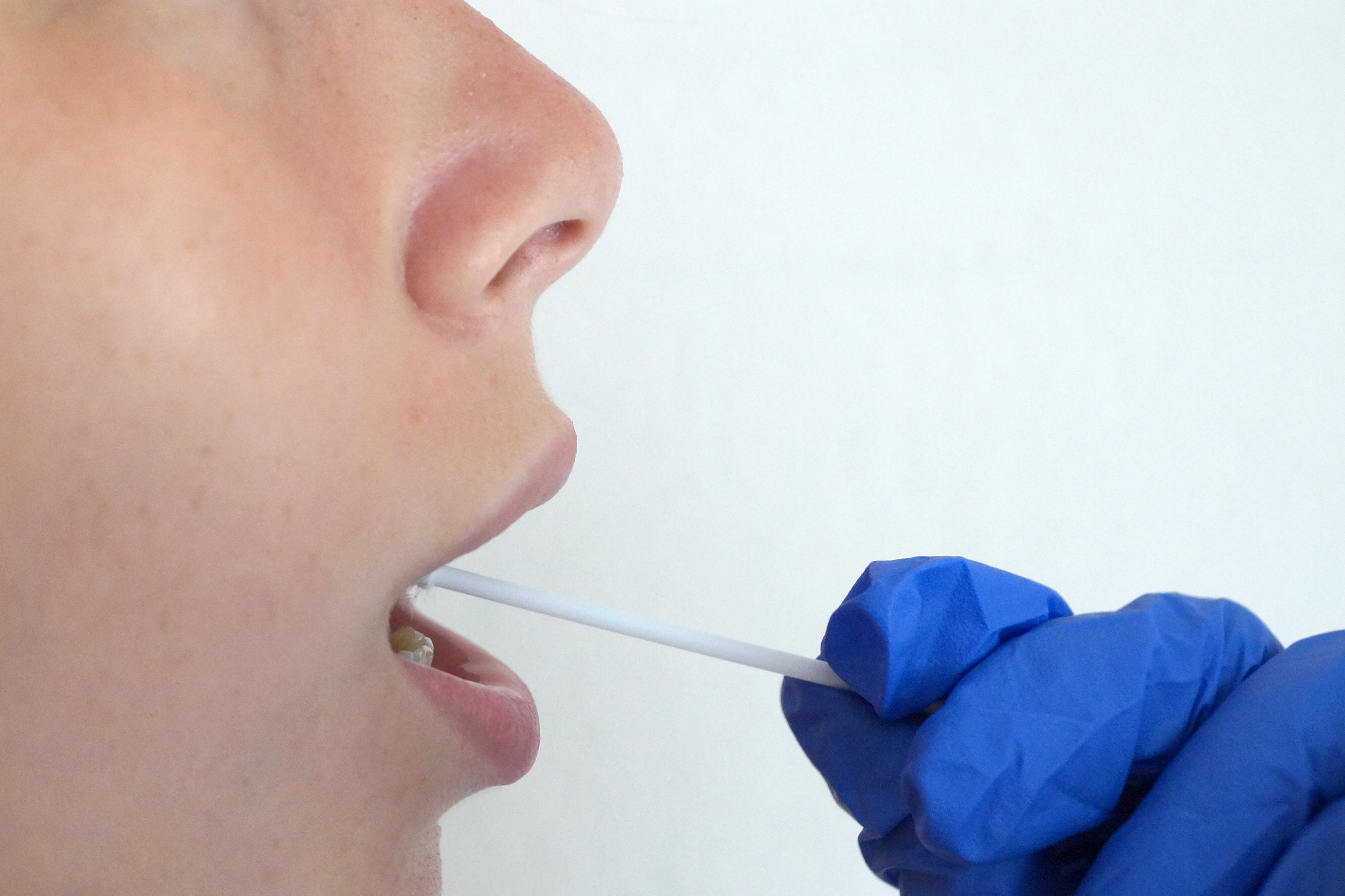 ¿Quién Debería Hacer una Prueba de ADN?